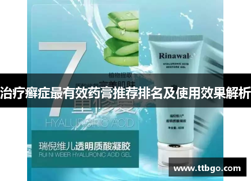 治疗癣症最有效药膏推荐排名及使用效果解析 治疗癣症最有效药膏推荐排名及使用效果解析